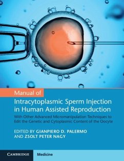 Manual of Intracytoplasmic Sperm Injection in Human Assisted Reproduction (eBook, ePUB)