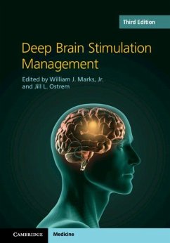 Cover Deep Brain Stimulation Management (eBook, PDF)