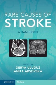 Rare Causes of Stroke (eBook, PDF)