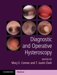 Cover Diagnostic and Operative Hysteroscopy (eBook, PDF)