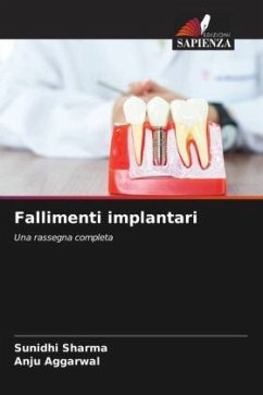 Fallimenti implantari - Sharma, Sunidhi;Aggarwal, Anju