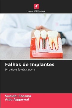 Falhas de Implantes - Sharma, Sunidhi;Aggarwal, Anju