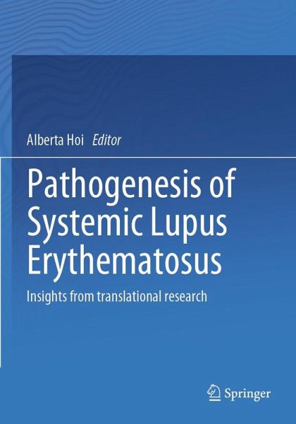 Pathogenesis of Systemic Lupus Erythematosus