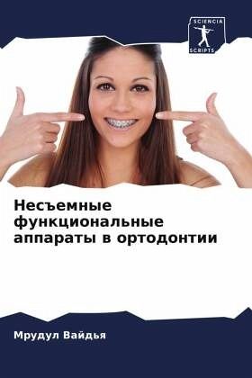 Nes#emnye funkcional'nye apparaty w ortodontii Nes#emnye funkcional'nye apparaty w ortodontii