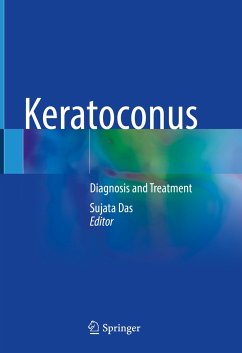 Keratoconus (eBook, PDF)