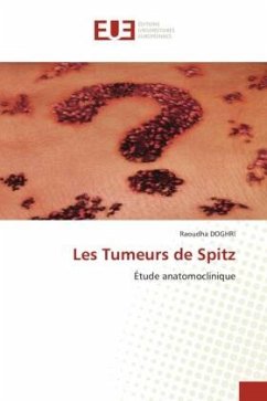 Les Tumeurs de Spitz - DOGHRI, Raoudha