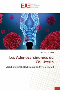 Les Adénocarcinomes du Col Uterin - DOGHRI, Raoudha