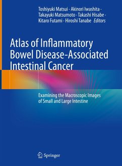 Atlas of Inflammatory Bowel Disease-Associated Intestinal Cancer (eBook, PDF)