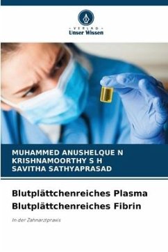 Blutplättchenreiches Plasma Blutplättchenreiches Fibrin - ANUSHELQUE N, MUHAMMED;S H, KRISHNAMOORTHY;Sathyaprasad, Savitha