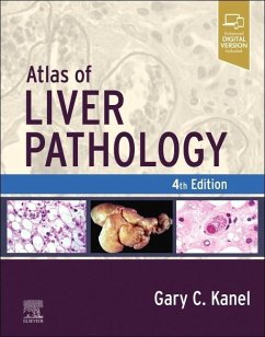 Atlas of Liver Pathology - Kanel, Gary C