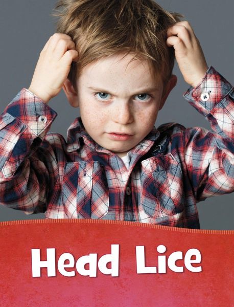 Head Lice (eBook, ePUB)