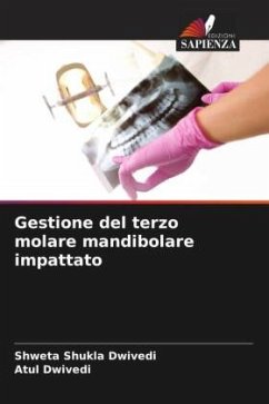 Gestione del terzo molare mandibolare impattato - Shukla Dwivedi, Shweta;Dwivedi, Atul