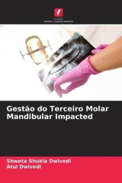 Gestão do Terceiro Molar Mandibular Impacted - Shukla Dwivedi, Shweta;Dwivedi, Atul