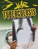 Tuberculosis (eBook, PDF)
