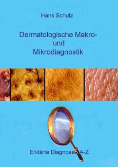Dermatologische Makro- und Mikrodiagnostik - Schulz, Hans