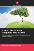 Lesão hepática e resposta imunitária