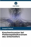 Knocheninvasion bei Plattenepithelkarzinom des Unterkiefers