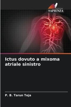 Ictus dovuto a mixoma atriale sinistro - Teja, P. B. Tarun