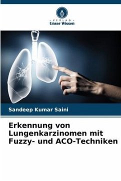 Erkennung von Lungenkarzinomen mit Fuzzy- und ACO-Techniken - Saini, Sandeep Kumar