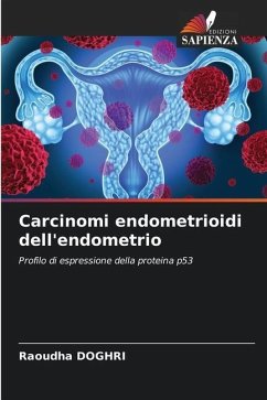 Carcinomi endometrioidi dell'endometrio - DOGHRI, Raoudha