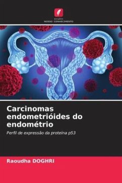 Carcinomas endometrióides do endométrio - DOGHRI, Raoudha