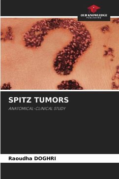 SPITZ TUMORS - DOGHRI, Raoudha