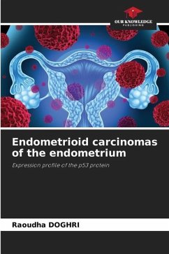 Endometrioid carcinomas of the endometrium - DOGHRI, Raoudha