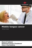 Mobile tongue cancer