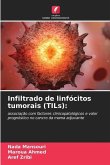 Infiltrado de linfócitos tumorais (TILs):