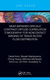 Near-infrared Speckle Contrast Diffuse Correlation Tomography for Noncontact Imaging of Tissue Blood Flow Distribution (eBook, ePUB)