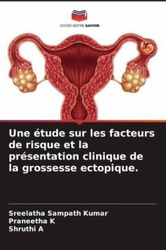 Une étude sur les facteurs de risque et la présentation clinique de la grossesse ectopique. - Sampath Kumar, Sreelatha;K, Praneetha;A, Shruthi