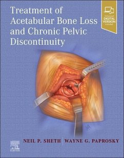 Treatment of Acetabular Bone Loss and Chronic Pelvic Discontinuity - Sheth, Neil P.; Paprosky, Wayne, MD, FACS (Professor, Department of Orthopaedics, Se