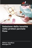 Selezione della tonalità nella protesi parziale fissa