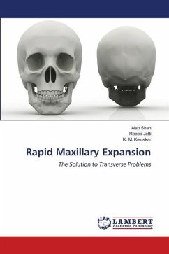 Rapid Maxillary Expansion