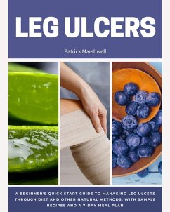 Leg Ulcer (eBook, ePUB) - Marshwell, Patrick