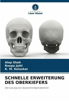 SCHNELLE ERWEITERUNG DES OBERKIEFERS - Shah, Alap;Jatti, Roopa;Keluskar, K. M.