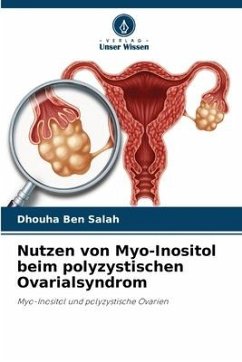 Nutzen von Myo-Inositol beim polyzystischen Ovarialsyndrom - Ben Salah, Dhouha