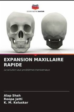 EXPANSION MAXILLAIRE RAPIDE - Shah, Alap;Jatti, Roopa;Keluskar, K. M.