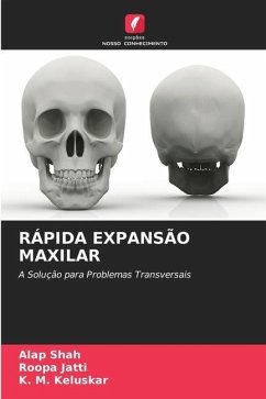 RÁPIDA EXPANSÃO MAXILAR - Shah, Alap;Jatti, Roopa;Keluskar, K. M.