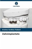 Zahnimplantate