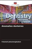 Anomalies dentaires