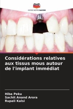 Considérations relatives aux tissus mous autour de l'implant immédiat - Peku, Hiba;Arora, Sachit Anand;Kalsi, Rupali