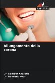 Allungamento della corona