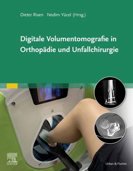 Digitale Volumentomografie in Orthopädie und Unfallchirurgie (eBook, ePUB) Digitale Volumentomografie in Orthopädie und Unfallchirurgie (eBook, ePUB)