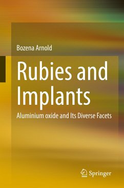 Rubies and Implants (eBook, PDF) - Arnold, Bozena