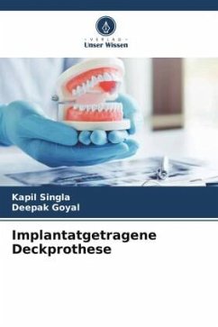 Implantatgetragene Deckprothese - Singla, Kapil;Goyal, Deepak