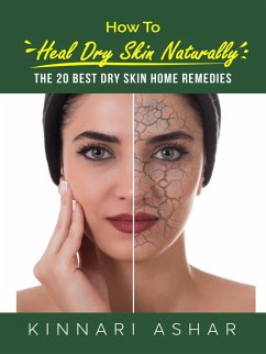 How to Heal Dry Skin Naturally (Natural Skin Care) (eBook, ePUB) - Ashar, Kinnari