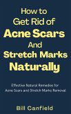 How to Get Rid of Acne Scars and Stretch Marks Naturally (eBook, ePUB)