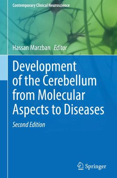 Development of the Cerebellum from Molecular Aspects to Diseases