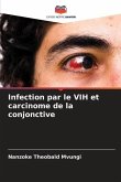 Infection par le VIH et carcinome de la conjonctive